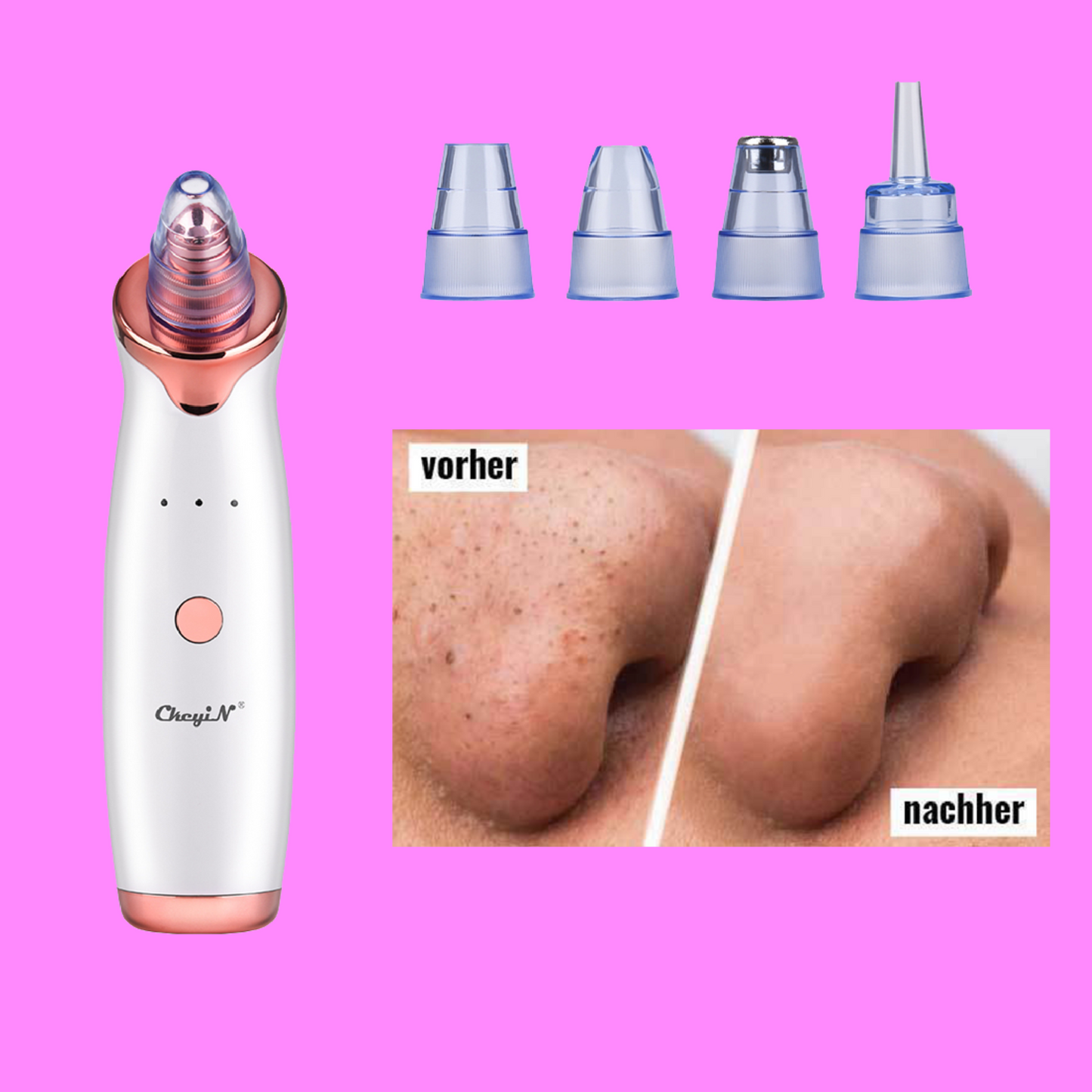 Shiny Blackhead Buster